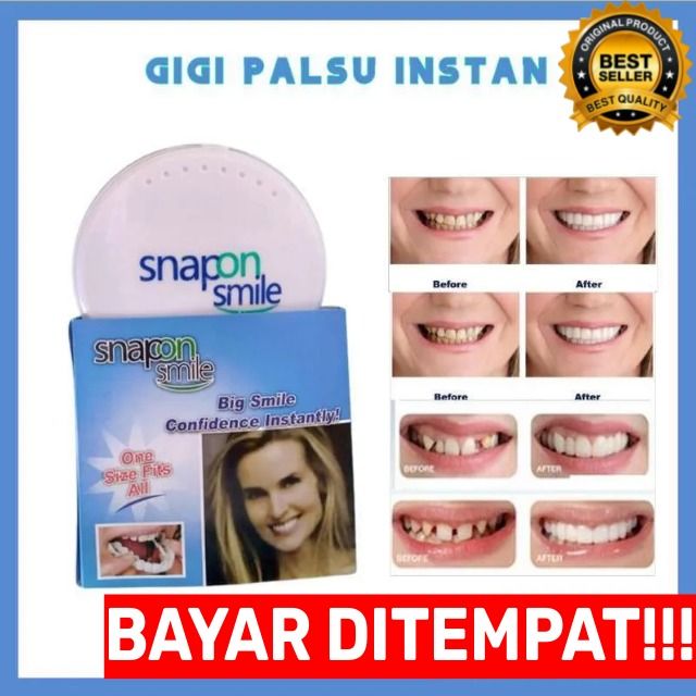 Snap On Smile 100 Original Authentic Gigi Palsu Snapon Smile 1 Set