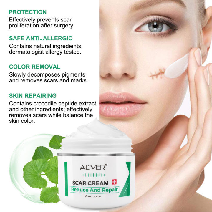 Original ALIVER Scar Repair Cream For Old Scar On Leg Stretch Mark