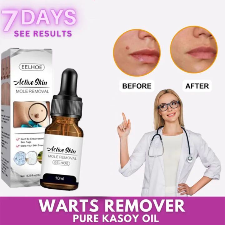 Warts Removal Serum Wart Removing Liquid Effective Warts Remover Skin