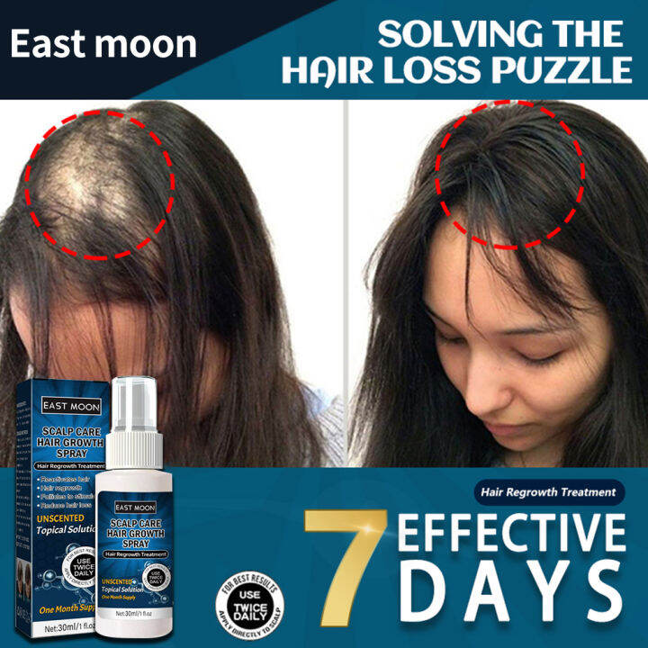 Firstsun Minoxidil Hair Grower For Men And Women 30ml Original Hair