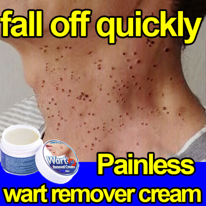 Wart Removal Cream Fast Remove Skin Tag Remover Original Ointment