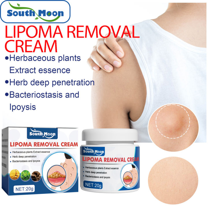 South Moon Lipoma Removal Cream Lipolysis Fat Lump Relief Anti Tumor