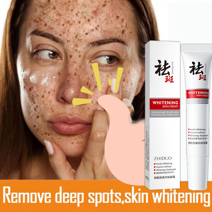 ZHIDUOWhitening Freckle Cream Removal Melasma Anti Aging Serum Pekas