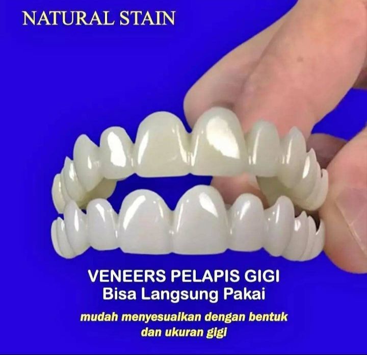 ONE Viral Snap On Smile Gigi Palsu Praktis Bisa Lepas Pasang 1 Set