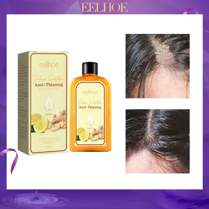 Eelhoe Dense Hair Shampoo Prevents Hair Loss Solidifies And Protects