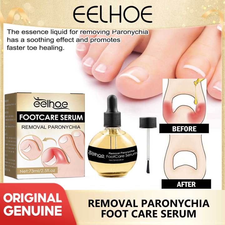 Eelhoe Nail Fungus Treatments Serum Repair Toe Fungal Products Removal