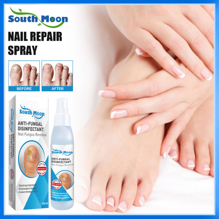 South Moon New Arrival Anti Fungal Disinfectant Nail Fungus Removal