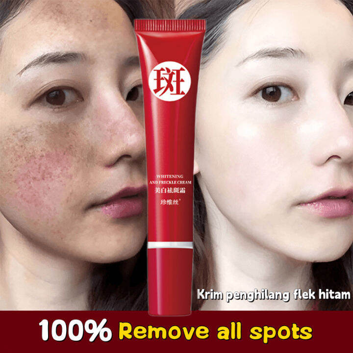 Whitening Blemish Flek Hitam Freckle Removal Cream Whitening Remove