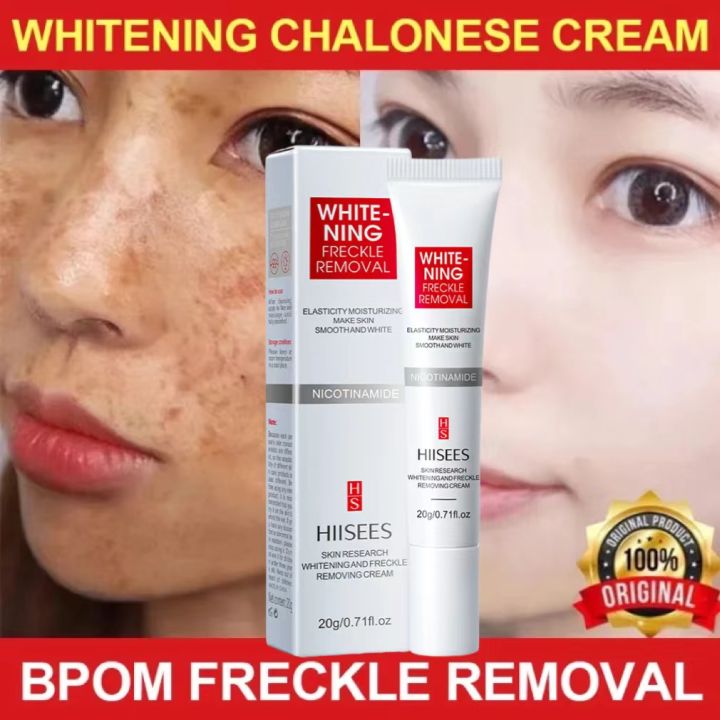 HIISEES Cream Penghilang Flex Hitam Whitening Freckle Remove Dark Spot