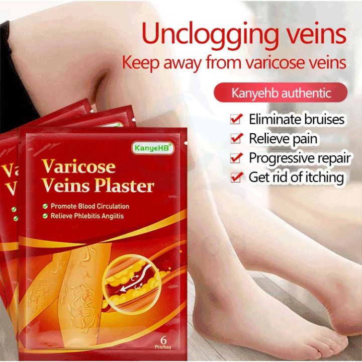 Pcs Pcs Pcs Varicose Veins Plaster Patch Pain Relief Relievers