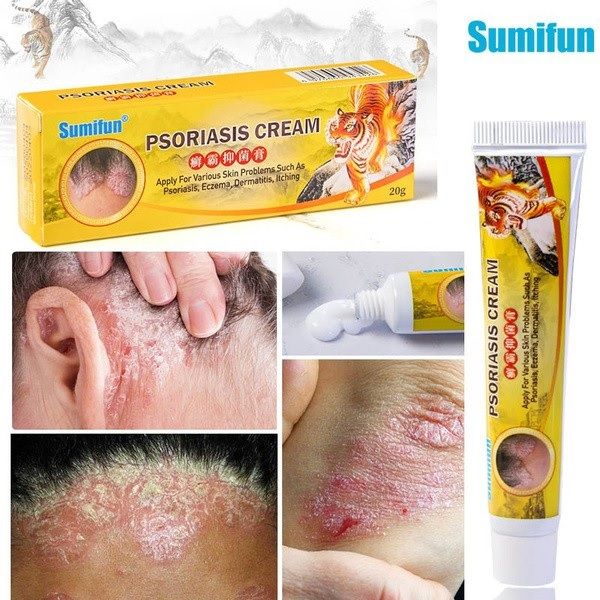 Original Sumifun G Herbal Psoriasis Dermatitis Eczema Pruritus Cream