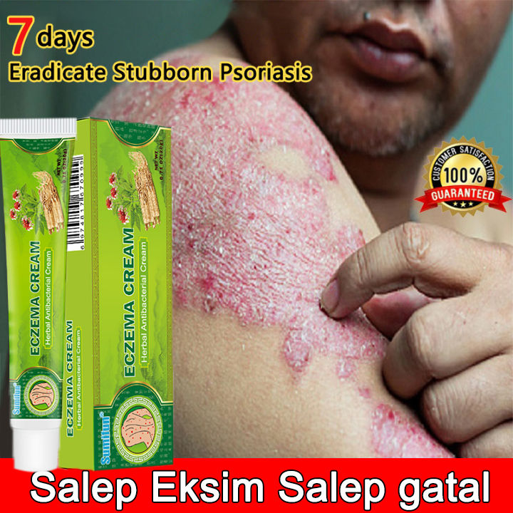 Salep Gatal Seconds To Relieve Itching Eczema Ointment Cream