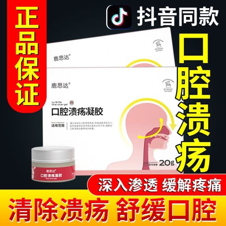 Lusida Oral Ulcer Gel Tongue Ulcer Spray Lip Foaming Swelling