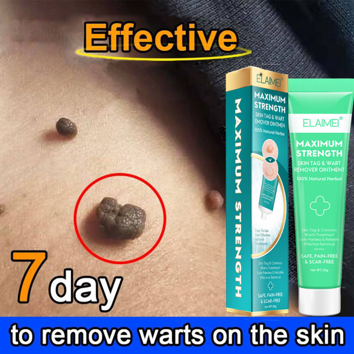 Fast And Painlesselaimei Warts Remover Original Skin Tags Remover