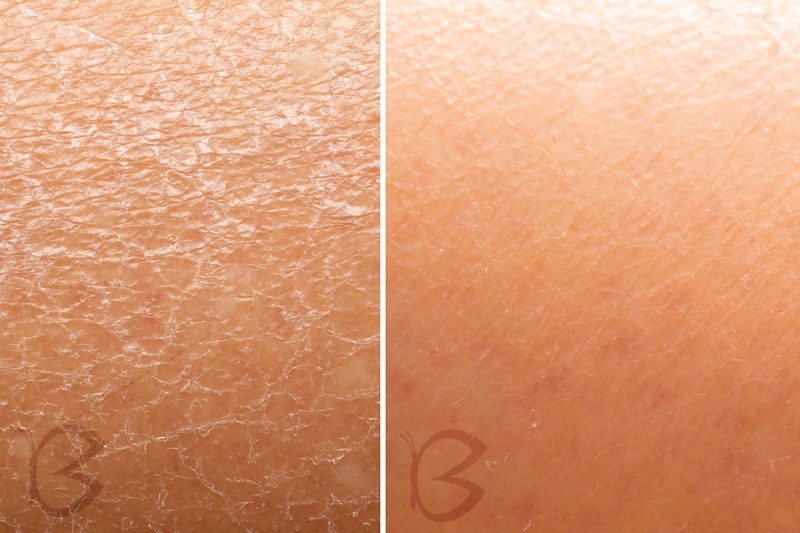 BEAUTIFLY - B-Derma Ice Pro Dispositivo de Limpieza Facial Profesional 9 en 1 – Microdermoabrasión con Luz LED, Lifting por Vacío, Compresas Frías/Calientes y 6 Cabezas Intercambiables - 1