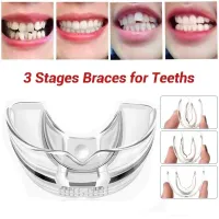 1 Pcs Teeth Corrector Braces Retainer Straighten Tools Tooth Care