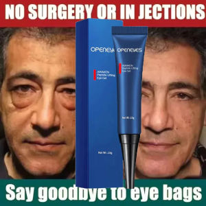 Men Retinol Eye Bags Remover Cream 2026 Openeyes Awake Dark Circle Lifting Gel Net Wt 15g | No surgery or injections say goodbye to eye bags.