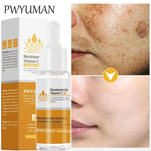 Powerful Dark Spots Remover Whitening Serum Face Freckle Melanin Correcting Anti Pigmentation Brighten Skin Beauty Care Products2026
