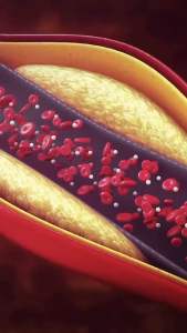 โคซานอล มัลติ แพลนท์ โอเมก้า 3 ออยล์ ไบโอแฟลกซ์ พลัส ไบดอแฟล็ก ไบโอแฟลก วัยทอง ฮอร์โมน ไขมันในเลือดสูง ความดัน เส้นเลือด เบาหวาน