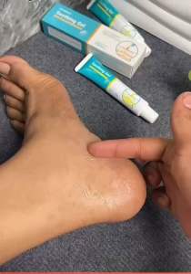 Dr Rerdia Soothing Gel Làm Dịu Da Hỗ Trợ Thư Giãn Vùng Cơ Khớp Chiết Xuất Nhân Sâm Nghệ Ngải Cứu Mềm Mịn 30g