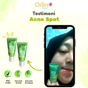 Acne Spot Chayra & Cream Totol Jerawat: Solusi Perawatan Kulit dengan Orlin Beauty BPOM