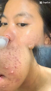 Brightening Serum Dosting NLS Skincare BPOM RI Aman Bumil dan Busui 🥰