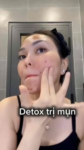Serum Mụn Lurcinn AC Detox HamadLAB- Giảm Mụn Mờ Thâm