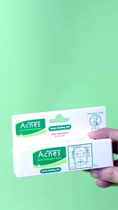 ✨ACNES✨ Treatment Sealing Jell 9g/18g: Solusi Perawatan Kulit Jerawat