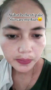 Toner & Sabun Cuci Muka Flek Platinum Orlin Beauty