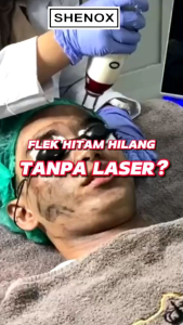 Salep Malam Obat Flek Hitam Bandel Shenox Night Cream