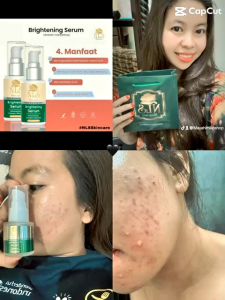 Paket Glowing Jerawat dan Flek (Basic+Serum free kapas) Original 100% BPOM RI Aman BumilBusui bisa COD