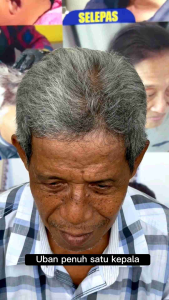 Beaudora Syampoo uban+3 FREE