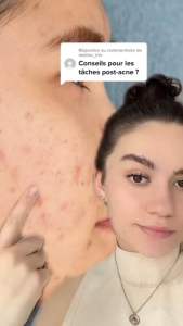 Serum Mờ Nám Trắng Da Caudalie Vinoperfect Anti-Dark Spot Radiance Serum 30ml