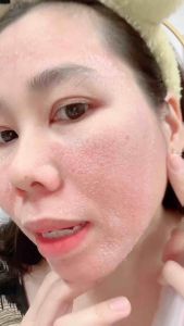 DETOX HỒNG SÂM DR CELL TÁI TẠO DA SẠCH NÁM DA KHOẺ TRẮNG HỒNG 50ml
