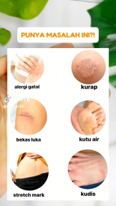 Paket Duo Bulus SR12 BPOM Membantu Mengencangkan Payudara & Memudarkan Strechmark Sabun Bulus & Minyak Bulus Terlaris