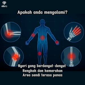 Susu Kambing etawa plus madu penurun kolesterol dan diabetes