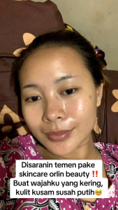 (BANYAK HADIAH) PAKET BRIGHTENING/WHITENING ORLIN BEAUTYMENCERAHKAN KULIT KUSAM
