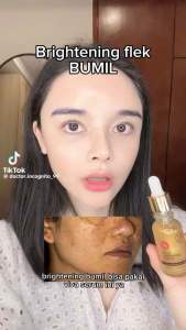 Viva Gold Whitening Serum (BEKAS JERAWAT/FLEK HITAM) Dyshop22