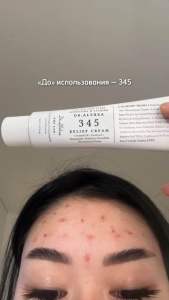 Kem Dưỡng Ẩm & Phục Hồi Da Dr.Althea 345 Relief Cream 50ml
