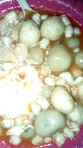 Baso Aci isi telor 1pcs
