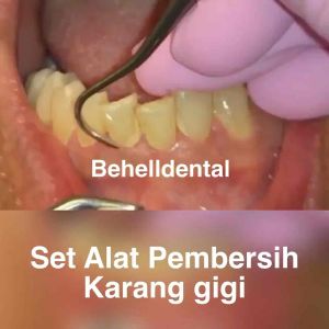 ALAT PEMBERSIH KARANG GIGI PLAK [ BESI ] Sonde Pinset Behel Bracket Kaca Mulut Set Instrument Mini Kit 3