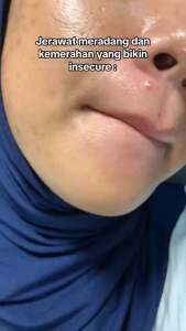 ( BPOM Approved ☑️) The Originote Mugwort B3 Clay Stick Mask - Masker Wajah Mugwort Acne Menenangkan dan Membuat Wajah Kencang dan Halus with Niacinamide