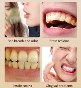 ยาสีฟันขิงขิง ยาสีฟันสมุนไพร ลดกลิ่นปาก ฟันขาว ฟันแข็งแรง ทำให้ปากสดชื่น Toothpaste 50g(T53)