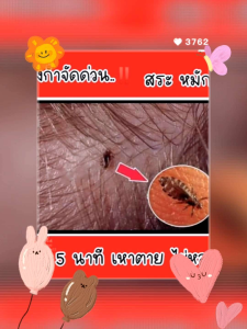 แชมพูสมุนไพรกำจัดเหาผิงอัน