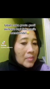 Day Cream Orlin Beauty Flek Platinum / Krim Siang Flek Tebal / Skincare bpom (free gift cantik)