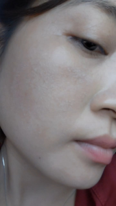 Serum HA Spa Mộc Nhân Dưỡng Trắng Trẻ Hóa Mờ Thâm Sạm Giảm Nếp Nhăn