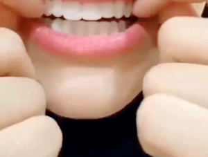 Snap On Smile gigi palsu instan atas bawah 100% Original