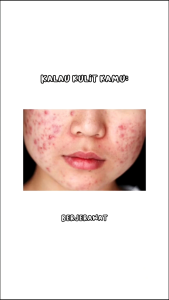 YOU Hy! Amino Facial Wash | Oil Control Hydarting Brightening Anti acne