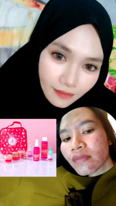 Mandela Beauty Care Original Paket MBC Skincare Cream Pemutih Kulit Cream Flek Cream Jerawat