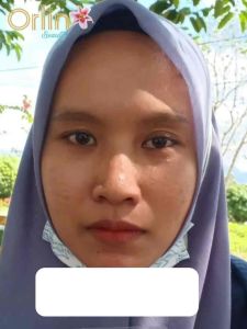 [ORLIN BEAUTY]ECER DAY CREAM + NIGHT CREAM BRIGHTENING KRIM SIANG & KRIM MALAM BRIGHTENING ORLIN KRIM PENCERAH KRIM SUSAH PUTIH KRIM BRIGHTENING KRIM BPOM WHITENING ORLIN BEAUTY KRIM NORMAL